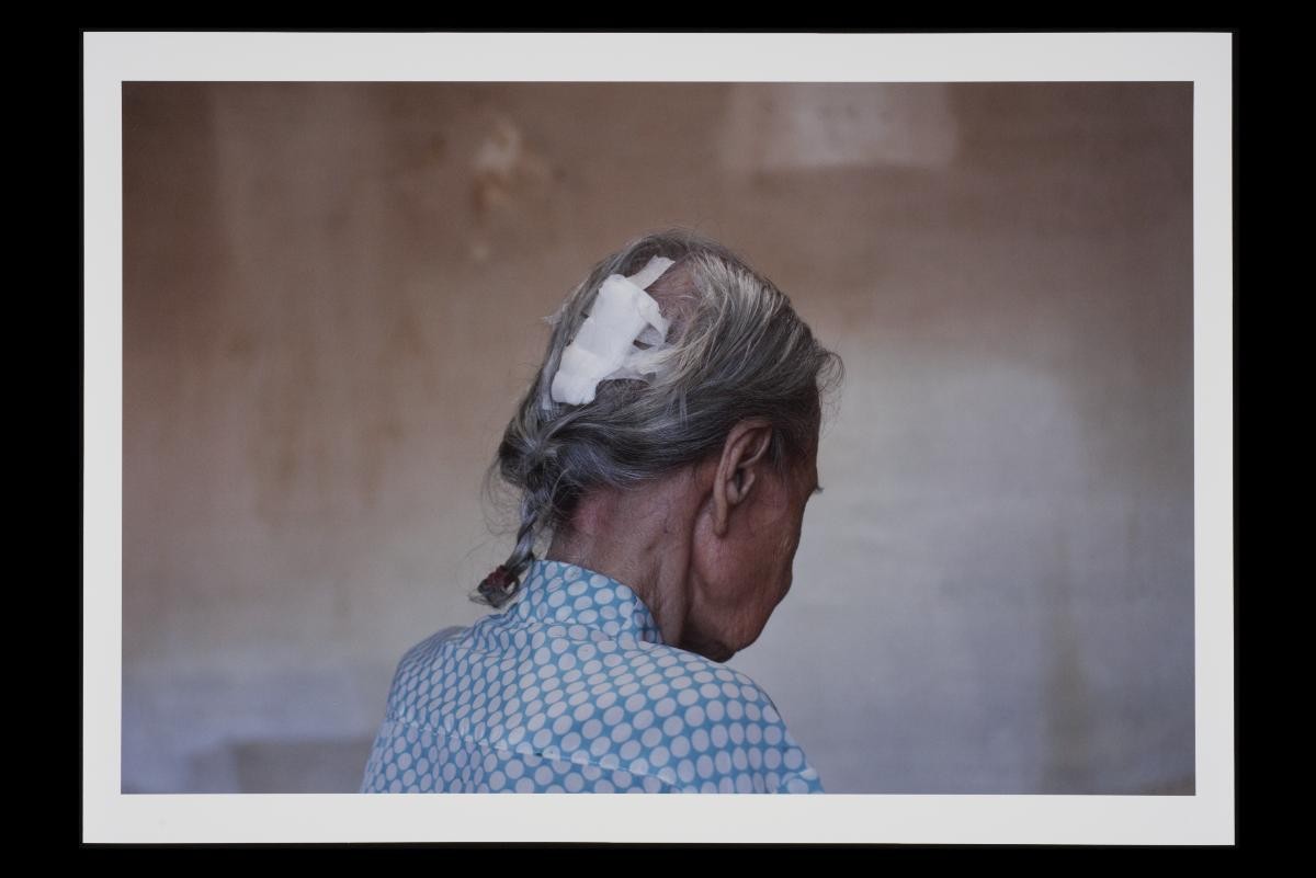 Bandaged cut at the back of Moon Teng Jie's head