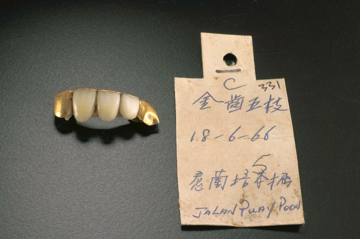 Gold teeth