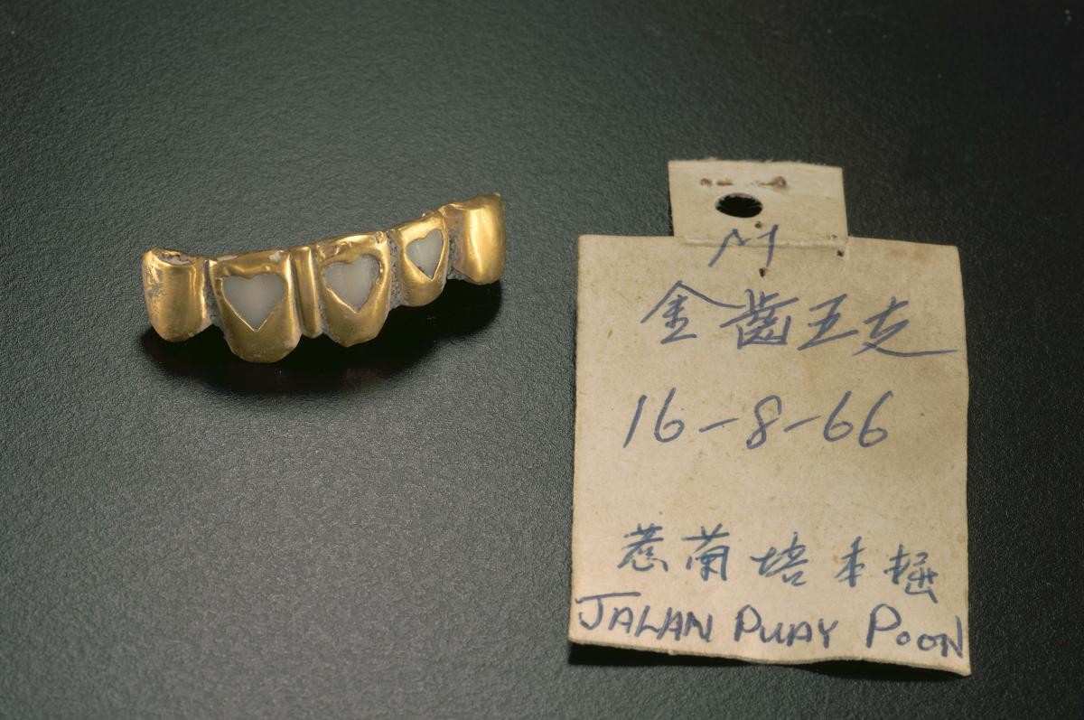 Gold teeth