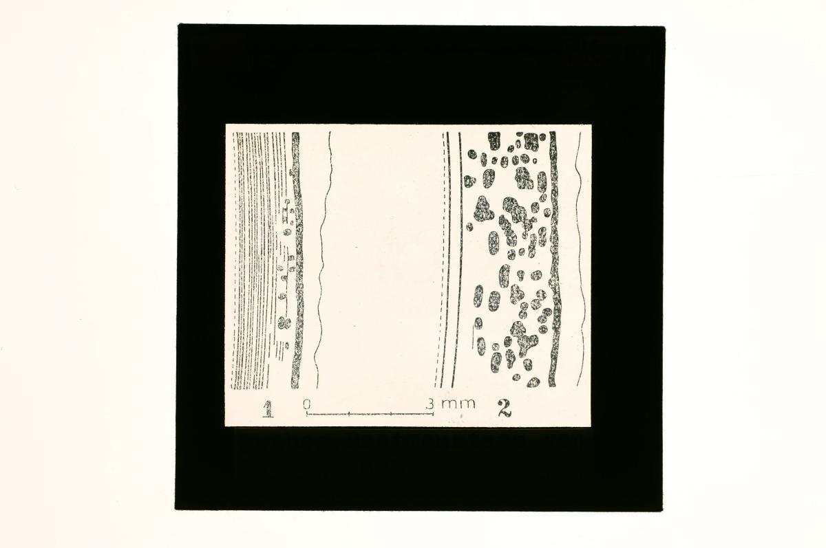 A glass lantern slide depicting a drawing of a stem cell