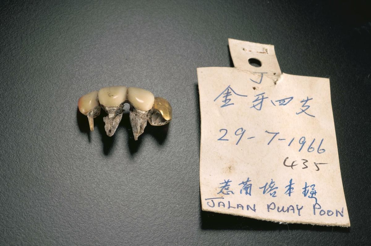Gold teeth